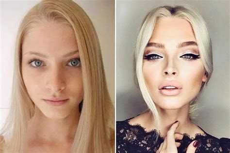 alena shishkova|Alena Shishkova. Photos before and after plastics. Biography, .